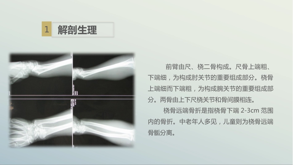 骨科-左桡尺骨双骨折的护理查房_第7页