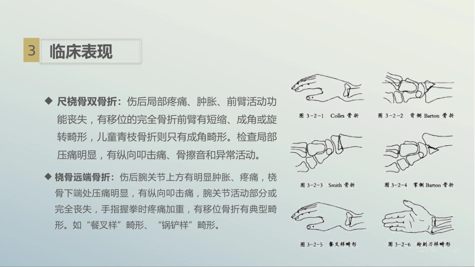 骨科-左桡尺骨双骨折的护理查房_第9页