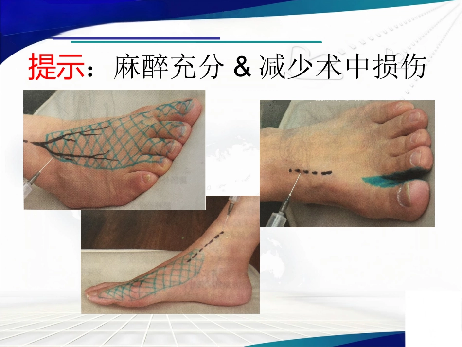 前足生理、病理解剖概述_第10页
