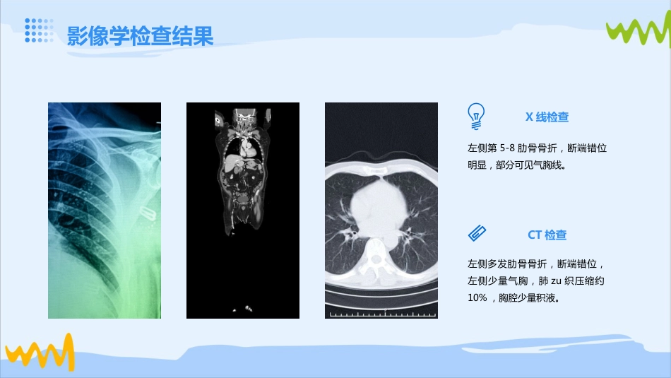 肋骨骨折疑难病例讨论_第6页