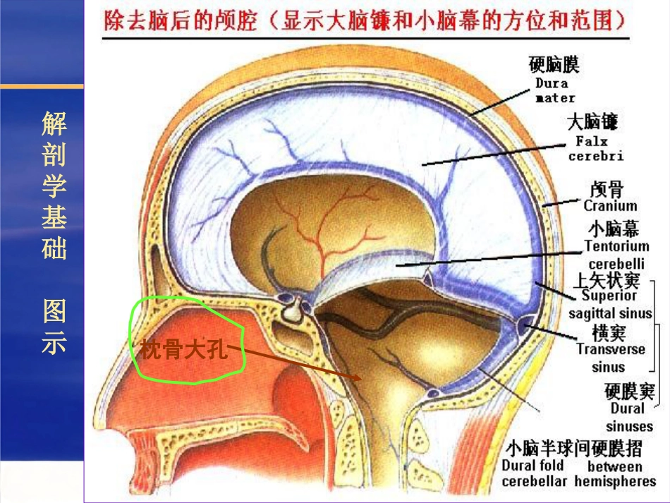 神经内科常见急危_第15页