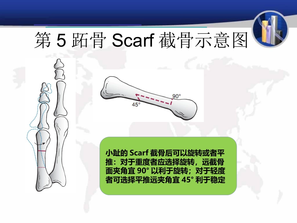小趾囊炎_第11页
