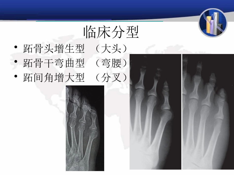 小趾囊炎_第8页