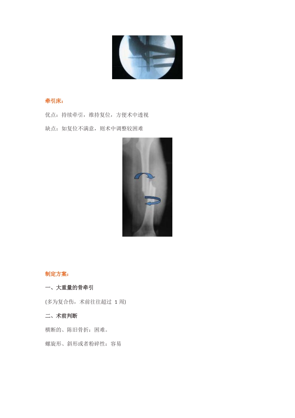 “金手指”在股骨干骨折闭合复位中的应用_第3页