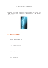 “金手指”在股骨干骨折闭合复位中的应用