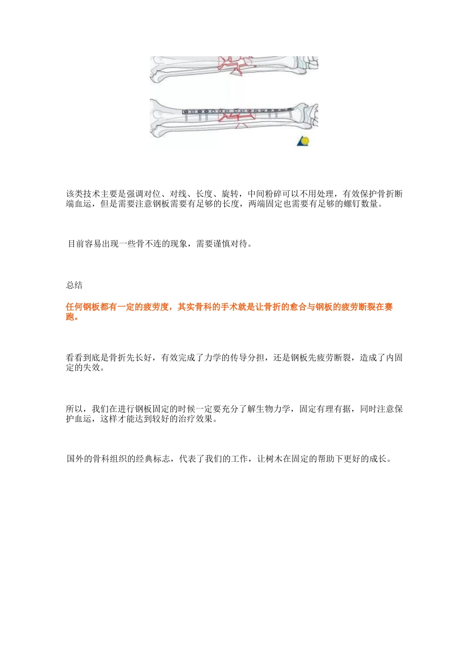 骨科最常用的钢板_第10页