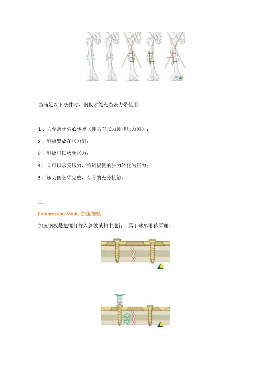 骨科最常用的钢板_第3页
