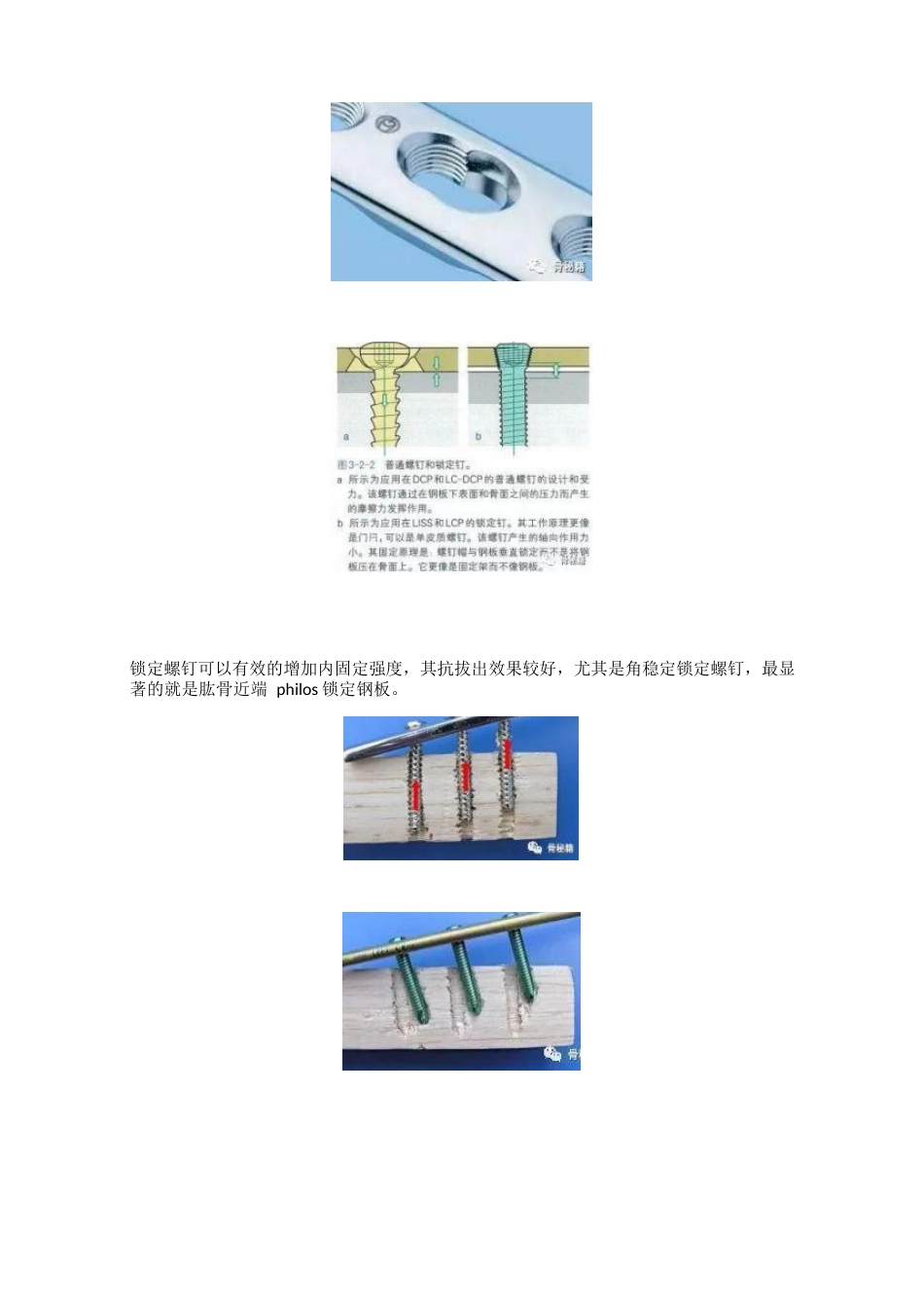 骨科最常用的钢板_第5页