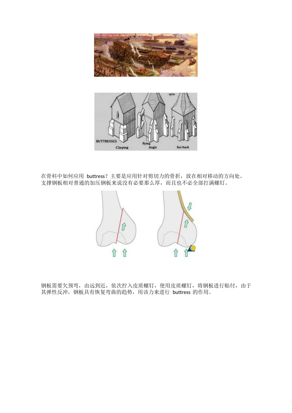骨科最常用的钢板_第8页