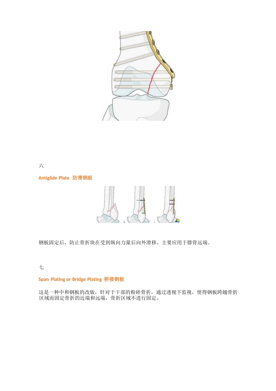 骨科最常用的钢板_第9页