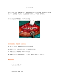 骨科最常用的钢板