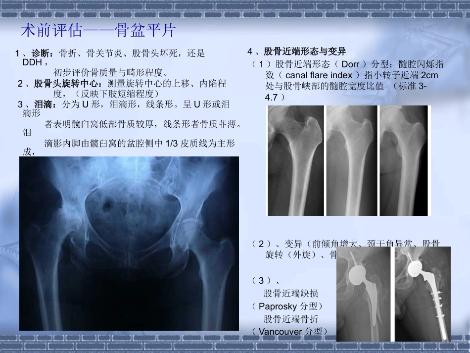 如何做好初次全髋关节置换_第11页