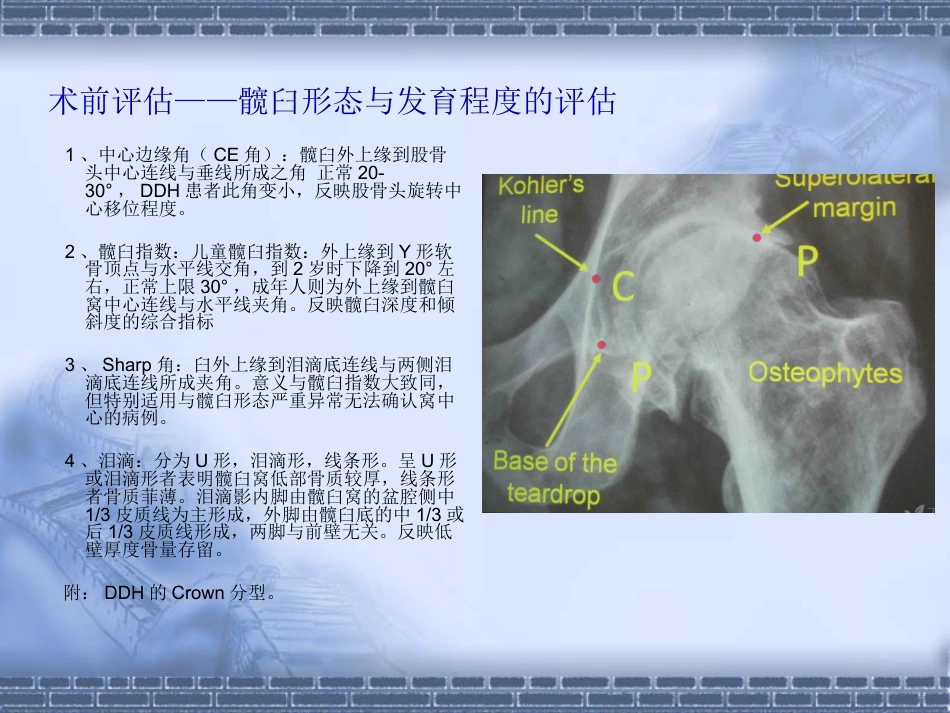 如何做好初次全髋关节置换_第12页