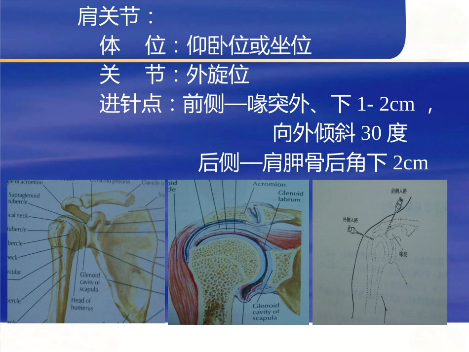 最新关节穿刺术_第7页