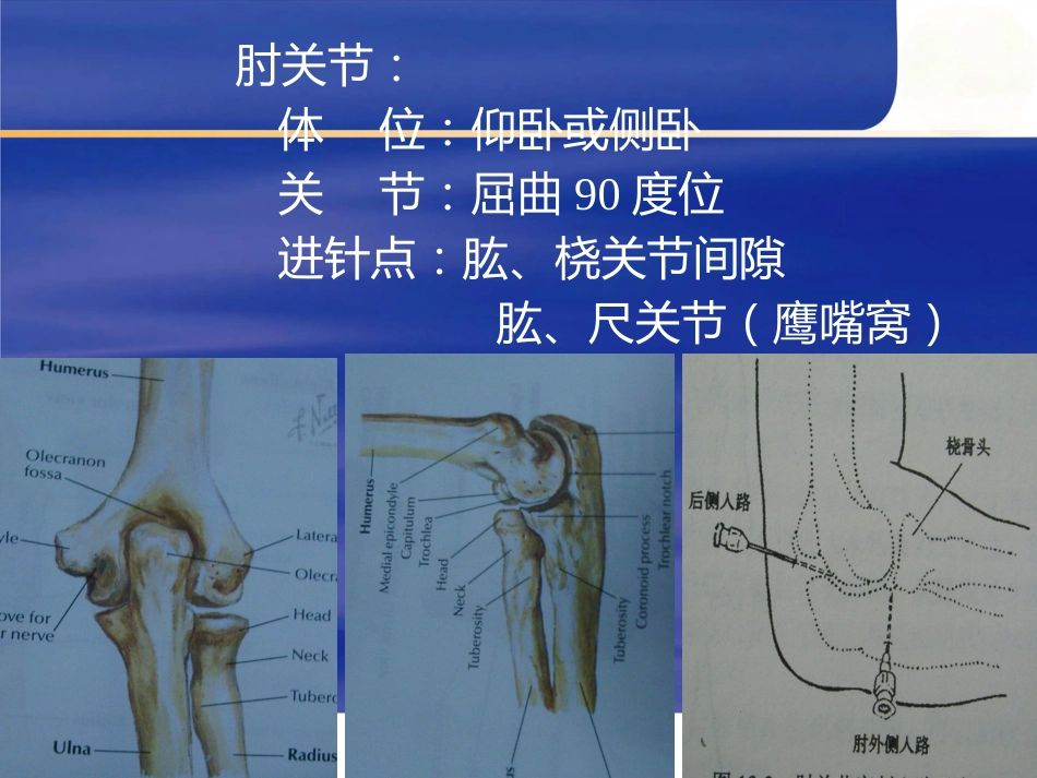关节穿刺术二_第12页
