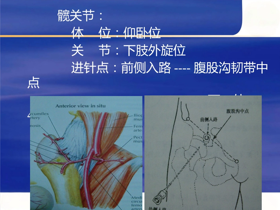 关节穿刺术二_第13页