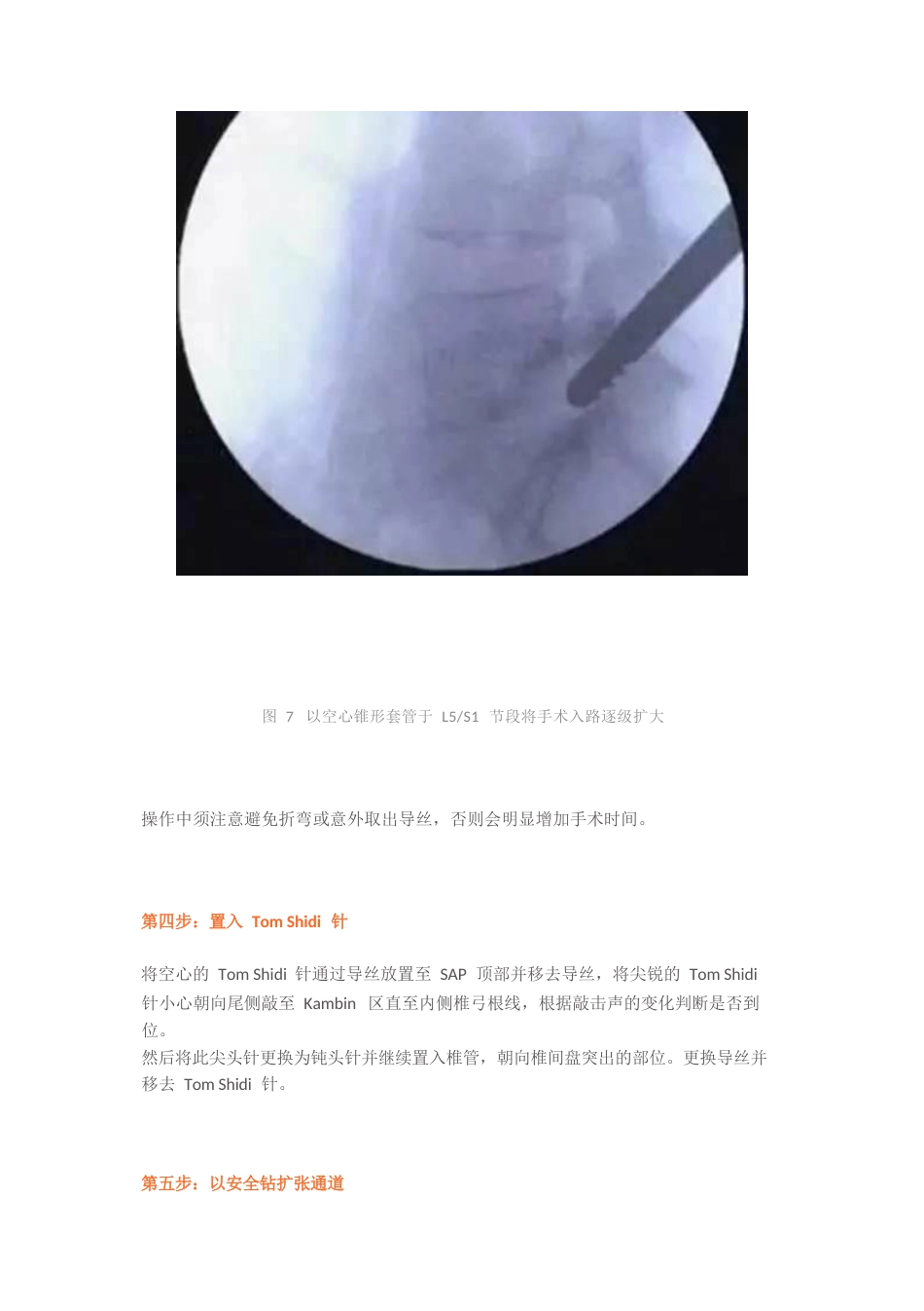 经皮椎间孔镜椎间盘切除术_第9页