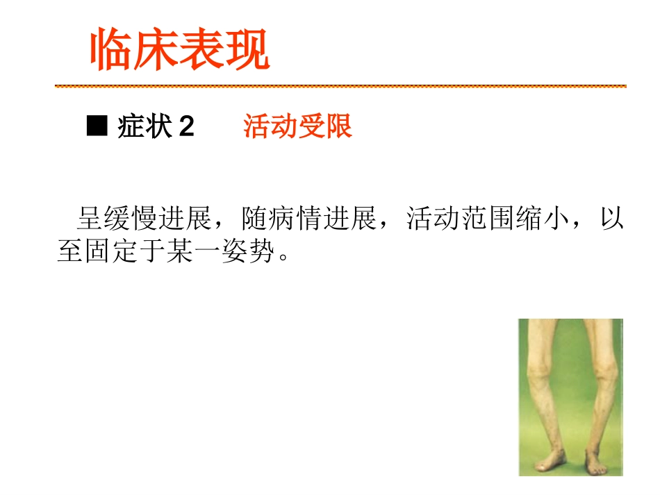 膝关节骨关节炎_第11页
