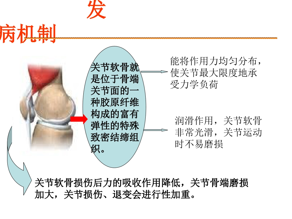 膝关节骨关节炎_第8页