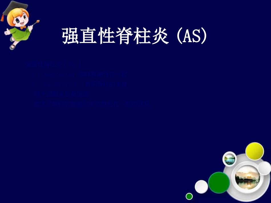 强直性脊柱炎ppt课件_第2页