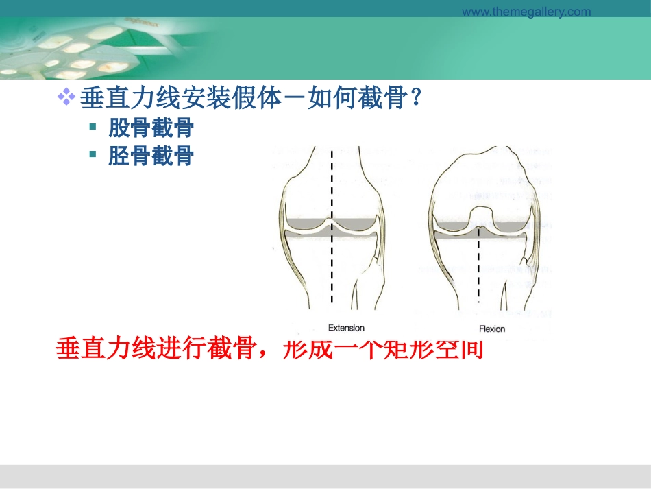 膝关节置换的手术操作和技巧_第10页