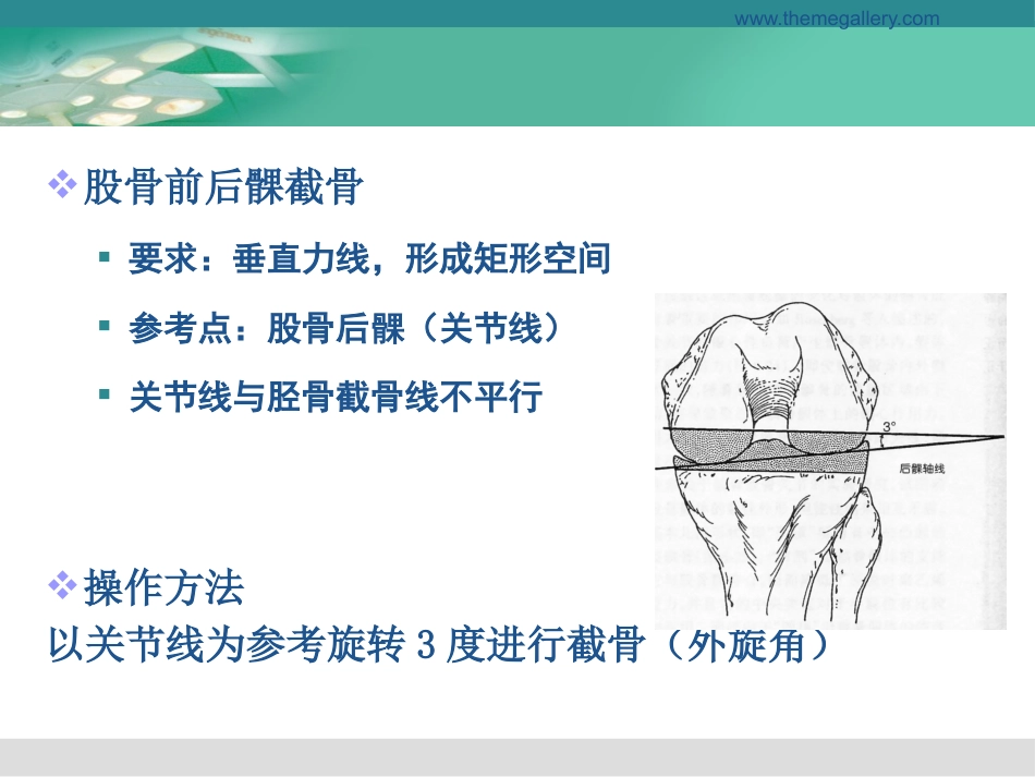 膝关节置换的手术操作和技巧_第14页