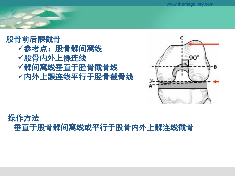 膝关节置换的手术操作和技巧_第15页