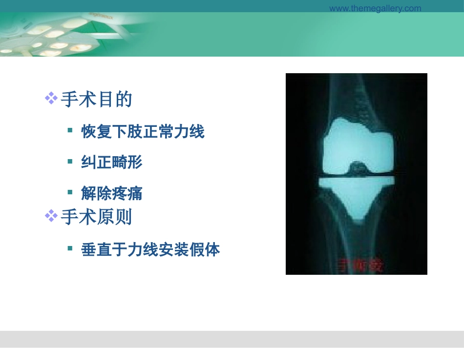 膝关节置换的手术操作和技巧_第7页