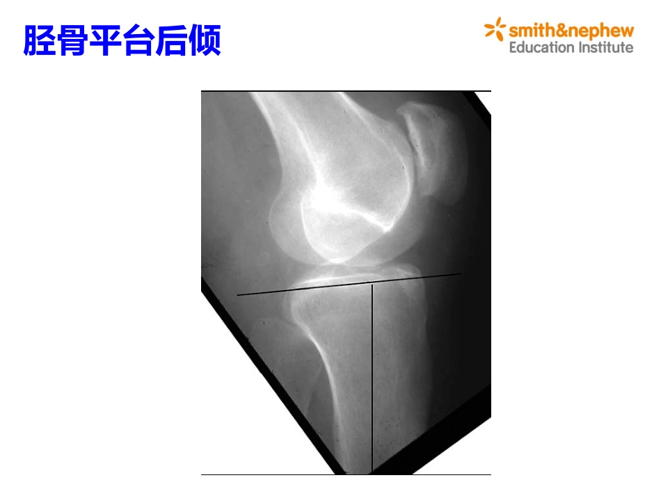 膝关节生物力学_第11页