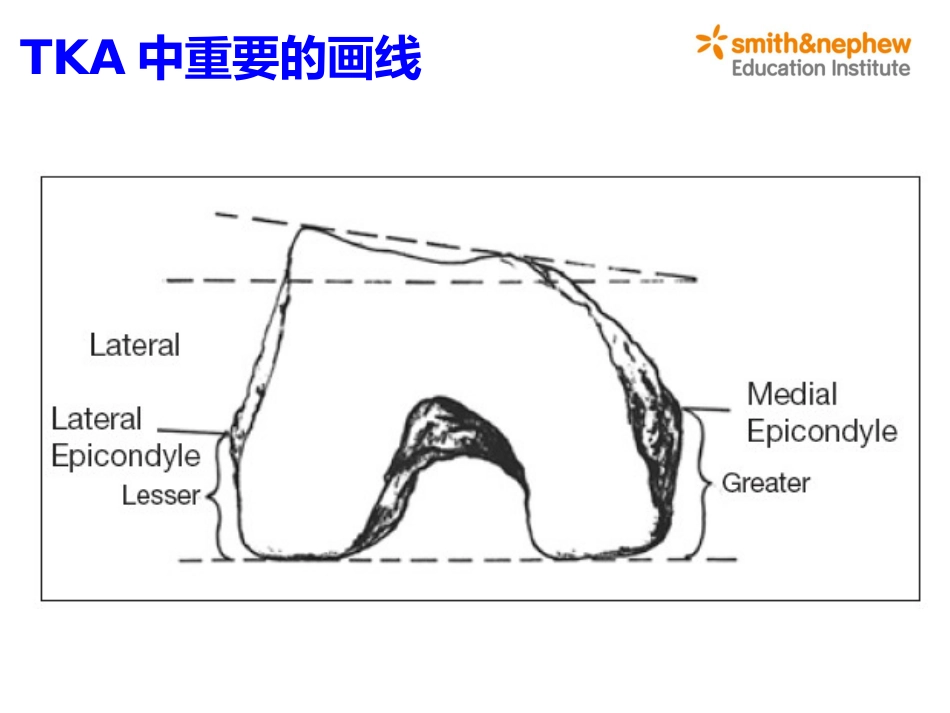 膝关节生物力学_第12页