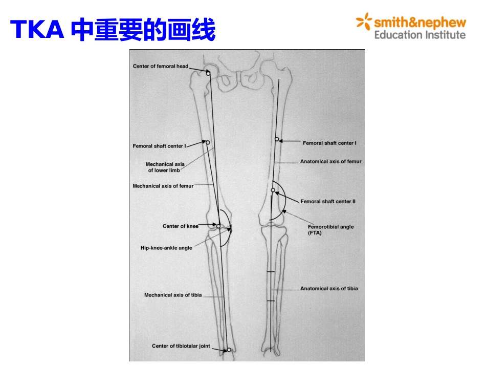 膝关节生物力学_第13页