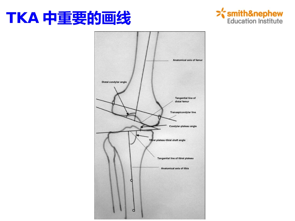 膝关节生物力学_第14页