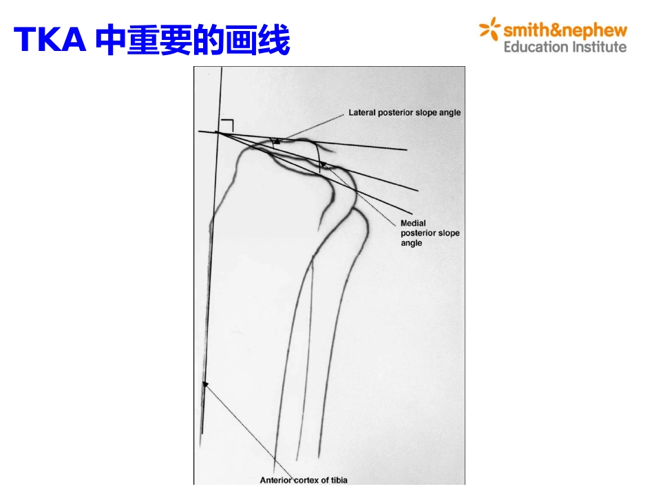 膝关节生物力学_第15页
