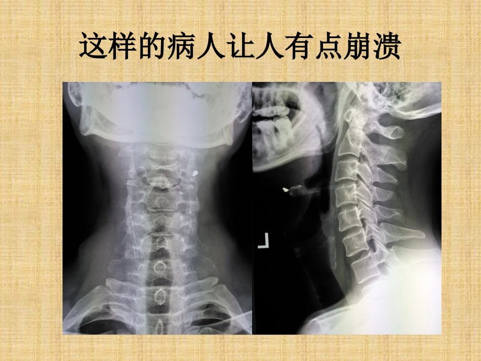 精准外科技术在四肢金属异物取出中的应用_第3页