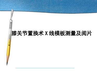 膝关节置换术术前X线模板测量及阅片