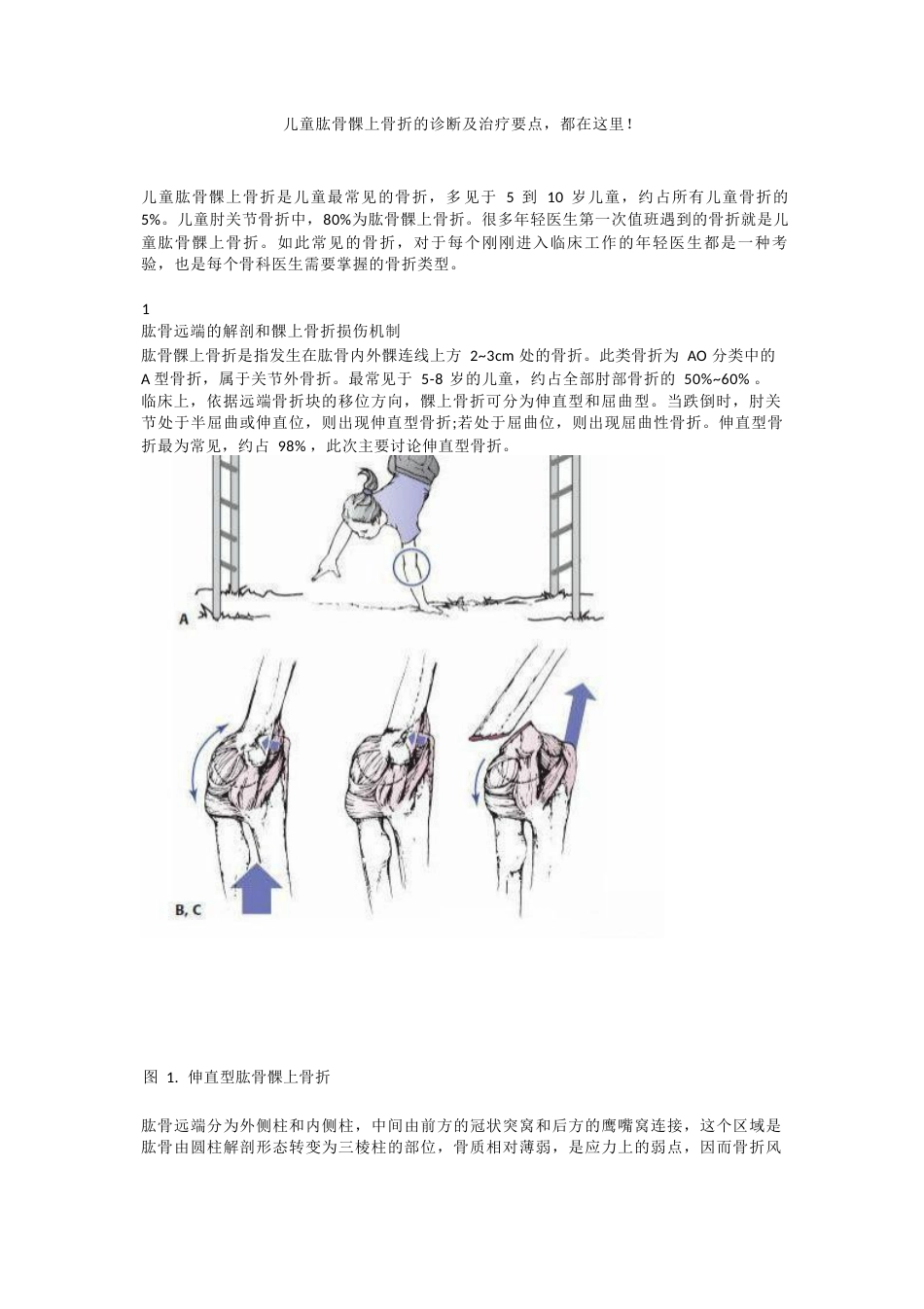 儿童肱骨髁上骨折的诊断及治疗要点_第1页