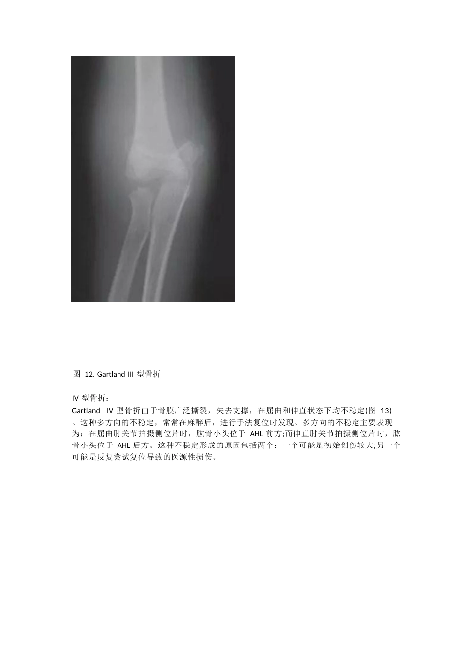 儿童肱骨髁上骨折的诊断及治疗要点_第10页