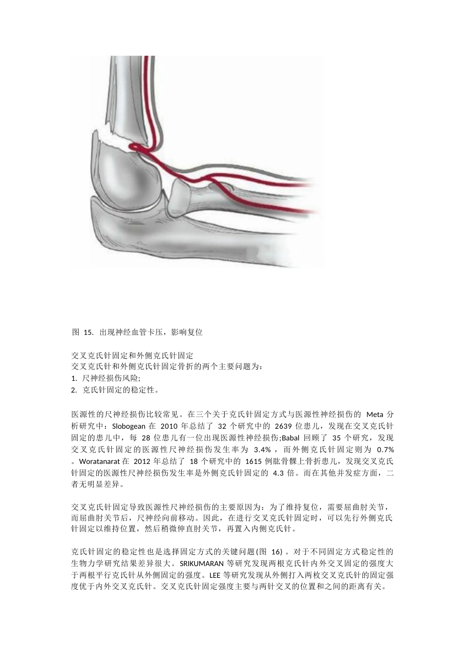 儿童肱骨髁上骨折的诊断及治疗要点_第14页