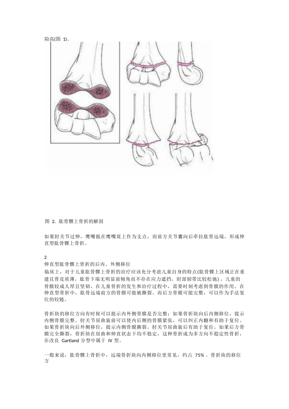 儿童肱骨髁上骨折的诊断及治疗要点_第2页