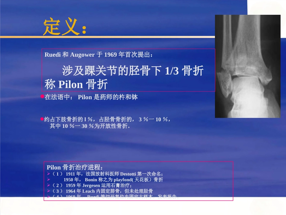 Pilon骨折的治疗_第2页