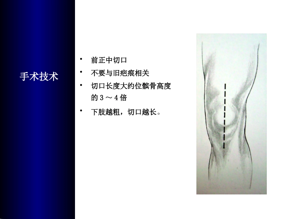 全膝关节置换术培训_第11页