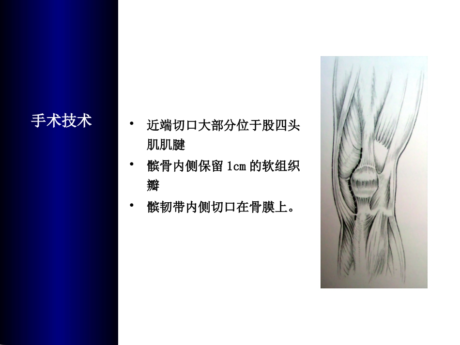 全膝关节置换术培训_第14页
