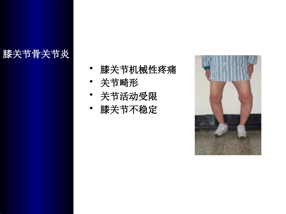 全膝关节置换术培训_第2页
