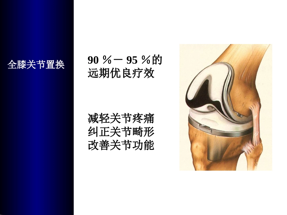 全膝关节置换术培训_第3页