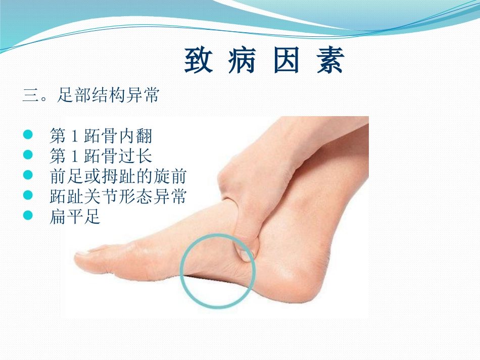 拇外翻的诊断治疗-ppt_第12页