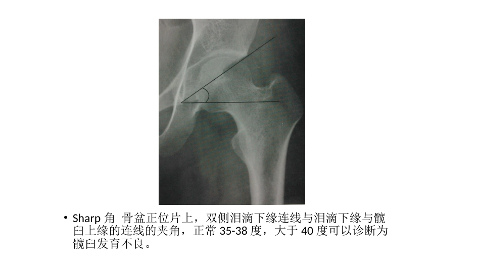 髋关节角度测量_第13页