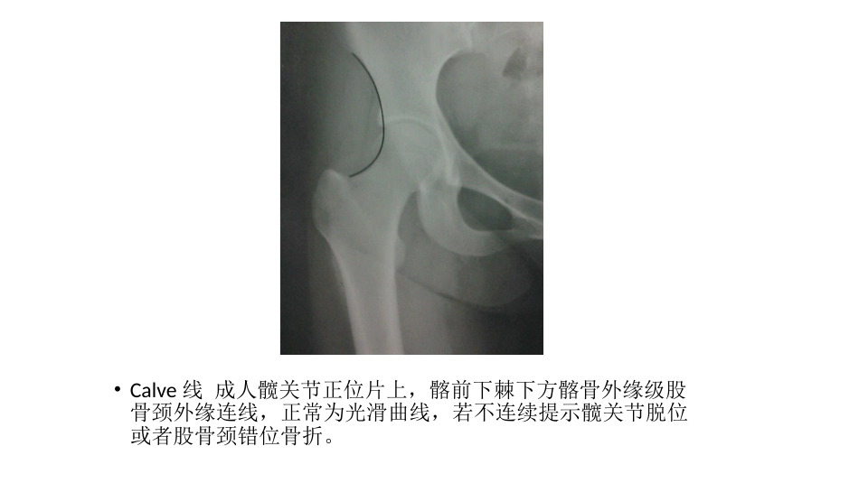 髋关节角度测量_第4页