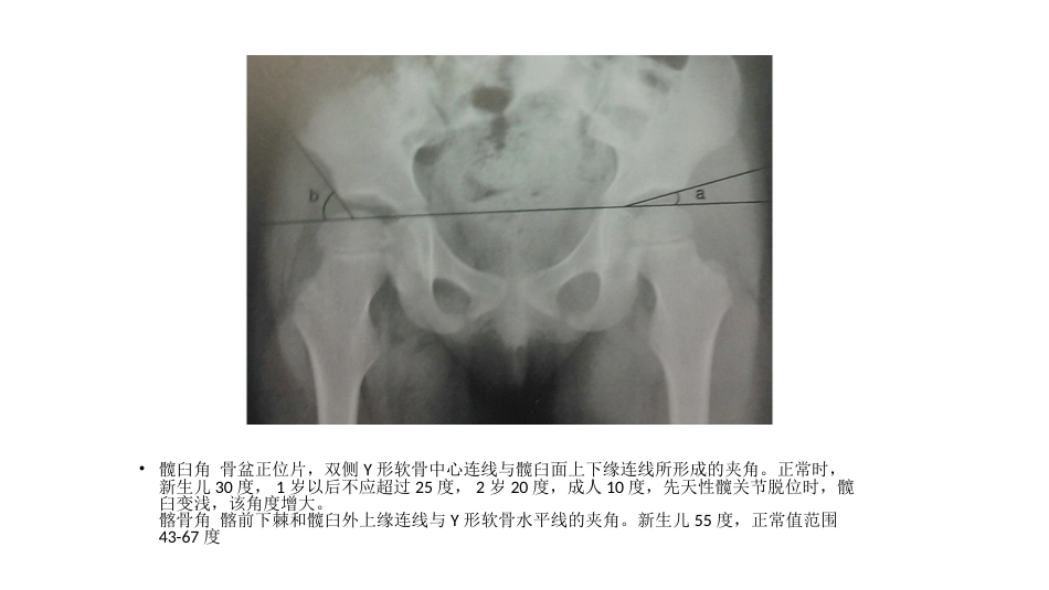髋关节角度测量_第9页