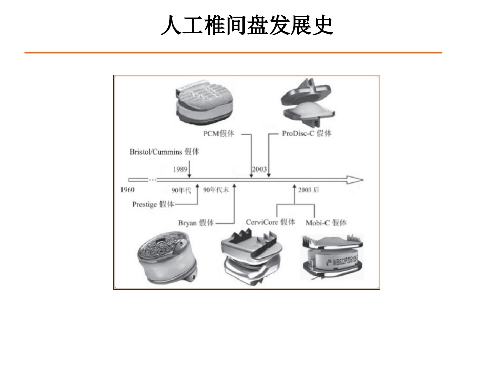 颈椎人工椎间盘CDR_第4页