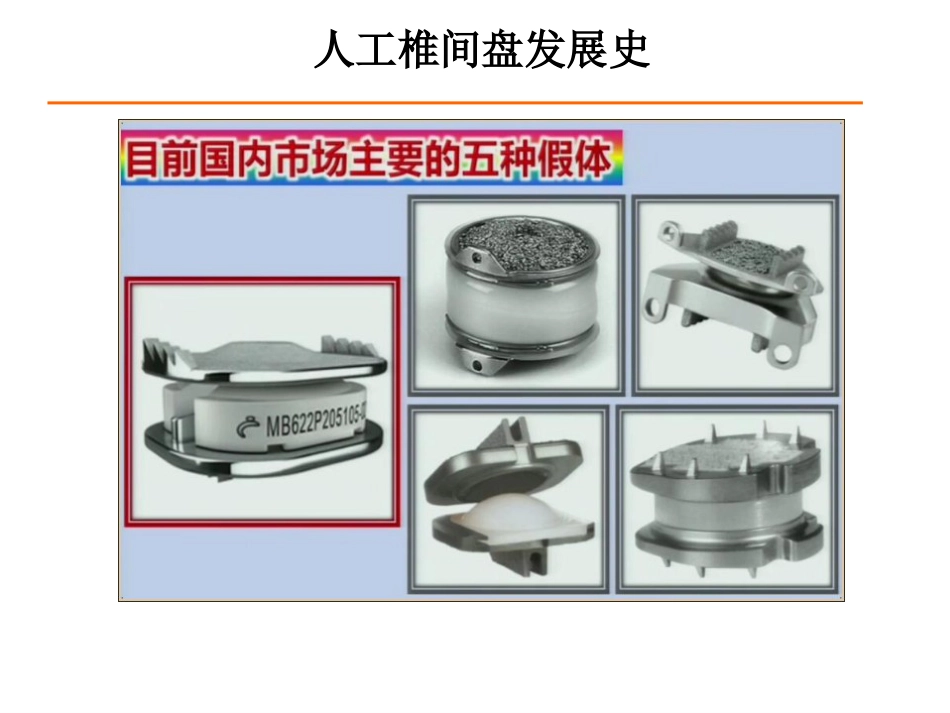 颈椎人工椎间盘CDR_第5页